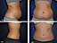 Caviliporesults