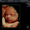 Cloud Nine 3d/4d Ultrasound
