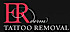 Erderm Tattoo Removal
