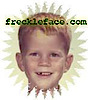 Freckleface