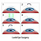 Lasik Michigan